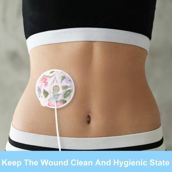 688c220b0c5604c6569c1d65d106be3d7f0e1c1486fbd38bf9dbd.jpg 36 Packs G Tube Button Covers Feeding Tube Supplies G Tube Accessories Nursing Pads Reusable G Tube Button Pad Abdominal Dialysis Feeding Tube Supplies for Kid Breastfeeding Stay Dry (Pattern)